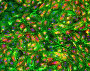 Synthetic coating kit for human endothelial cells(1)